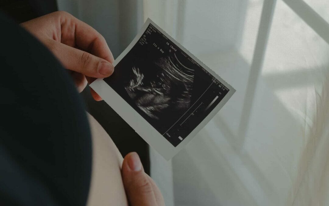 First-Trimester Screening