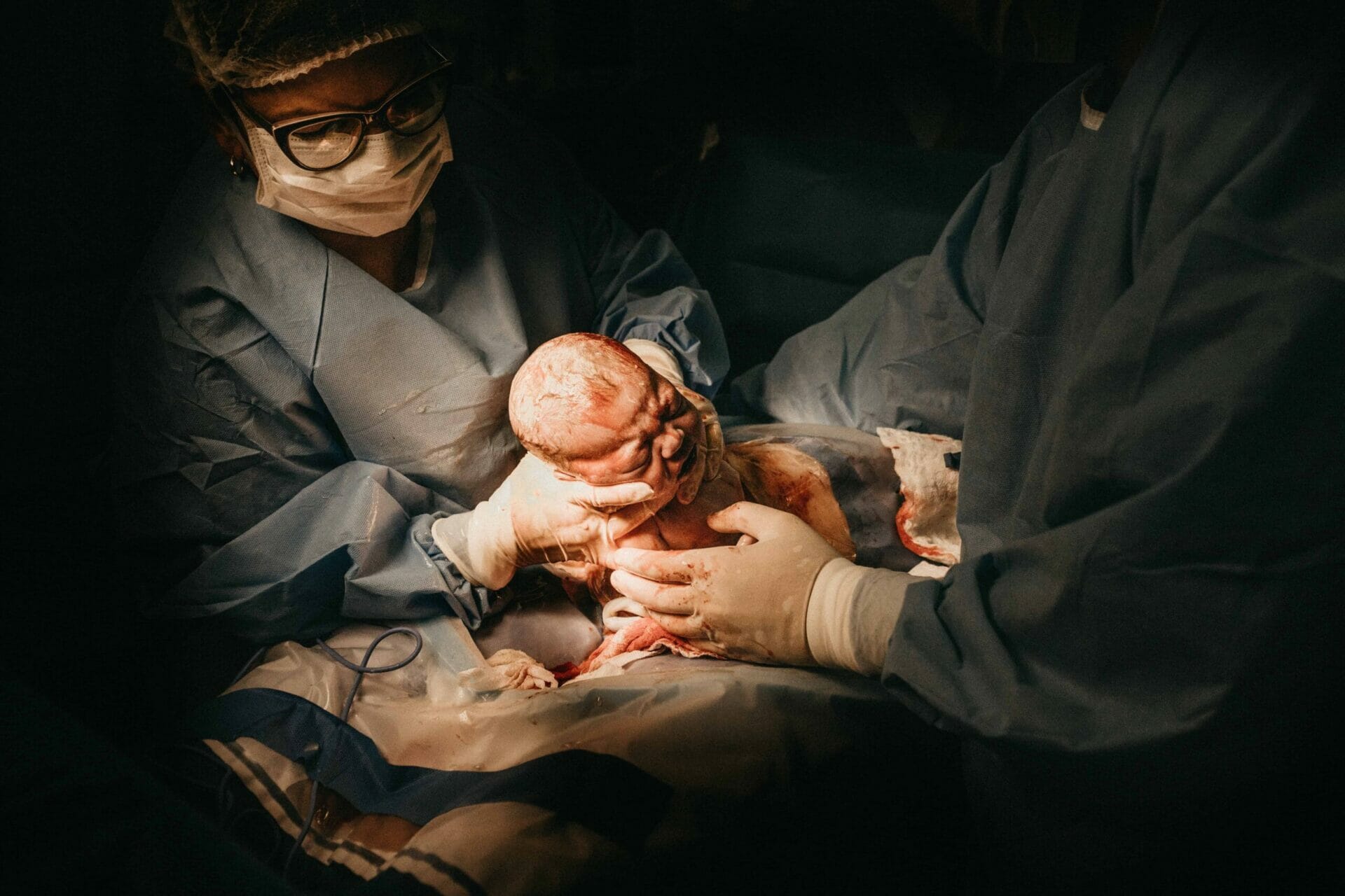 Potential Risks of a Cesarean Procedure